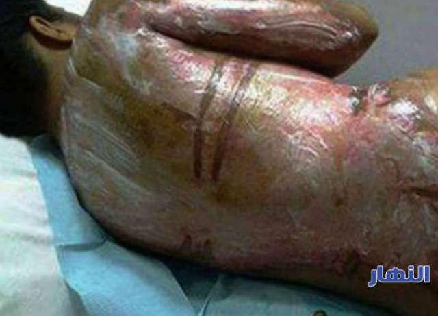 صورة أرشيفية