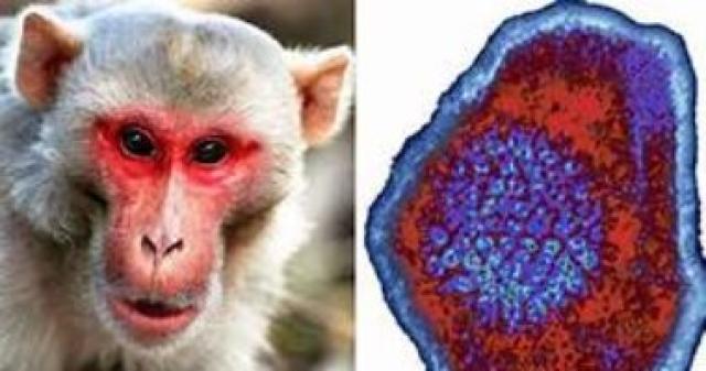 الصحة تكشف أعراض الإصابة بجدرى القرود.. تعرف عليها