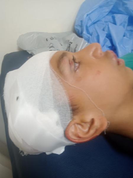 الإسماعيلية: إصابة طالب إعدادي بكسر بالجمجمة في مشاجرة مع زميله بحوش المدرسة