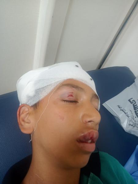 الصور الأولى للطالب ضحية مشاجرة مدرسة المستقبل بالإسماعيلية