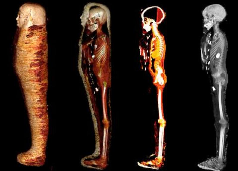 فحص بالأشعة المقطعية يخرج مومياء ”الصبي الذهبي” من بدروم المتحف المصري لساحة العرض