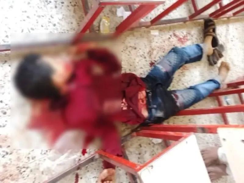 اليمن : في جريمة حوثية بشعة مسلح حوثي يذبح طفلاً داخل مدرسة أمام زملائه