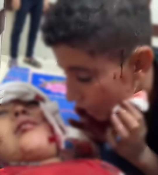 صغارهم رجال.. مشهد مأساوي لطفل فلسطيني يلقن أخيه الشهادة جراء الأحداث الأخيرة في غزة