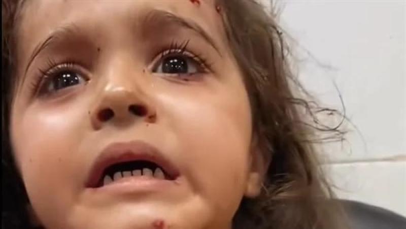 ”قصفوا أمي وقصفوني”.. مأساة طفلة فلسطينية أبكت العالم