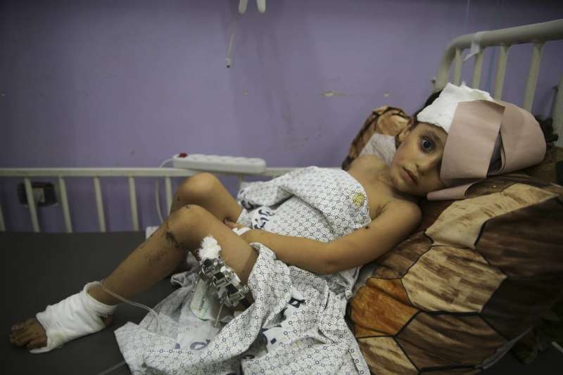 ”اليونيسف”: أطفال غزة يصلون للمستشفيات بعظام مكسورة