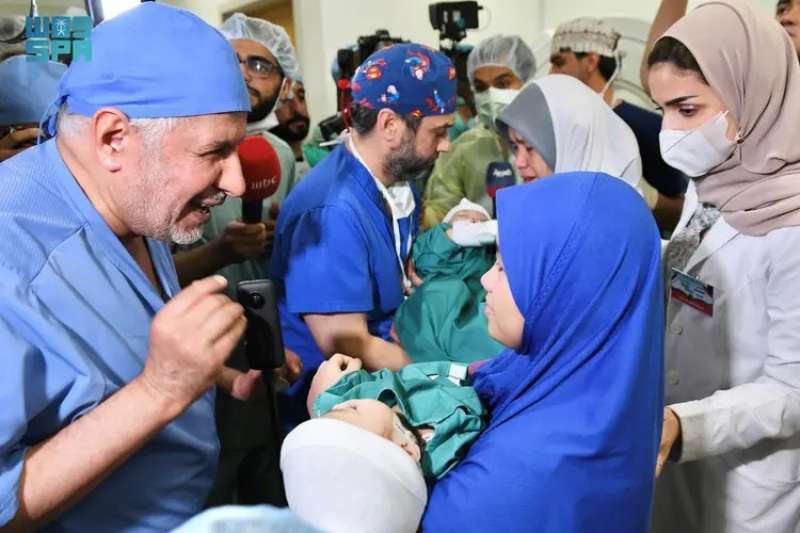 السعودية: نجاح فصل التوأم السيامي الفلبيني ”أكيزا وعائشة” بعد عملية جراحية دقيقة استغرقت 5 ساعات