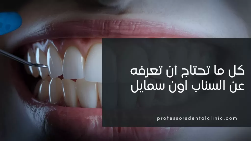 سناب اون سمايل – دليلك الشامل لابتسامة هوليود المتحركة