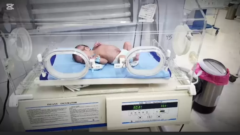 فى جراحة دقيقة بـ” ميت غمر العام”.. إنقاذ حياة طفل رضيع وُلد بأمعاء خارج الجسم