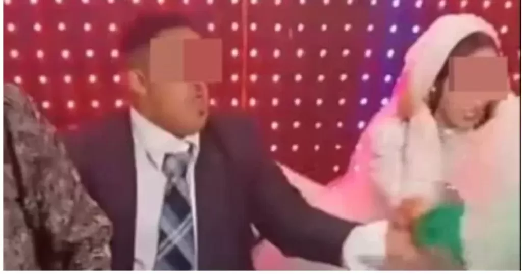 بعد واقعة زفاف الشرقية.. هل يحق لمصاب متلازمة داون الزواج والإنجاب؟