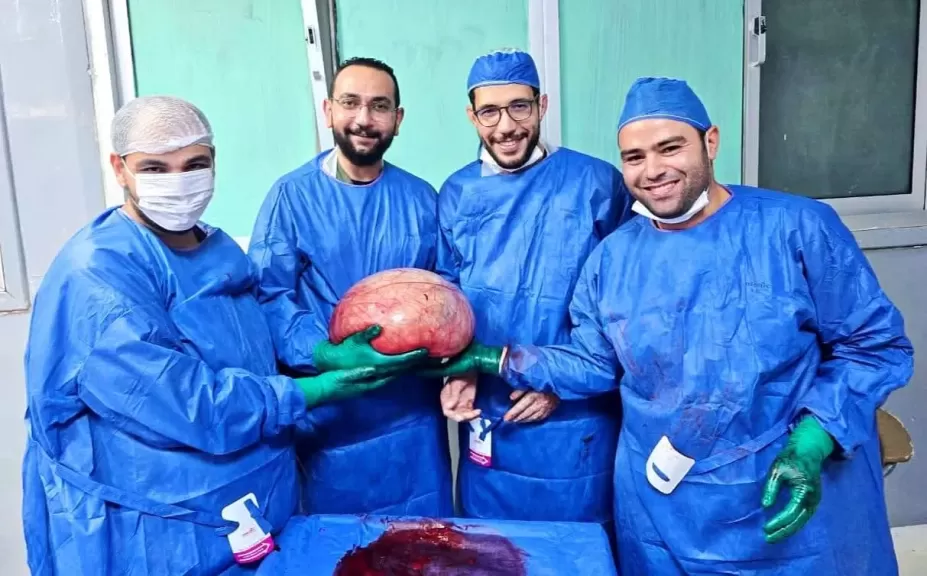 نجاح طبي جديد: استئصال ورم ضخم أنقذ حياة فتاة بمستشفى الفيوم العام