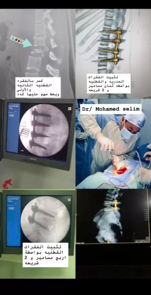 جراحات دقيقة تنقذ 3 مريضات من الشلل بمستشفى تمي الأمديد