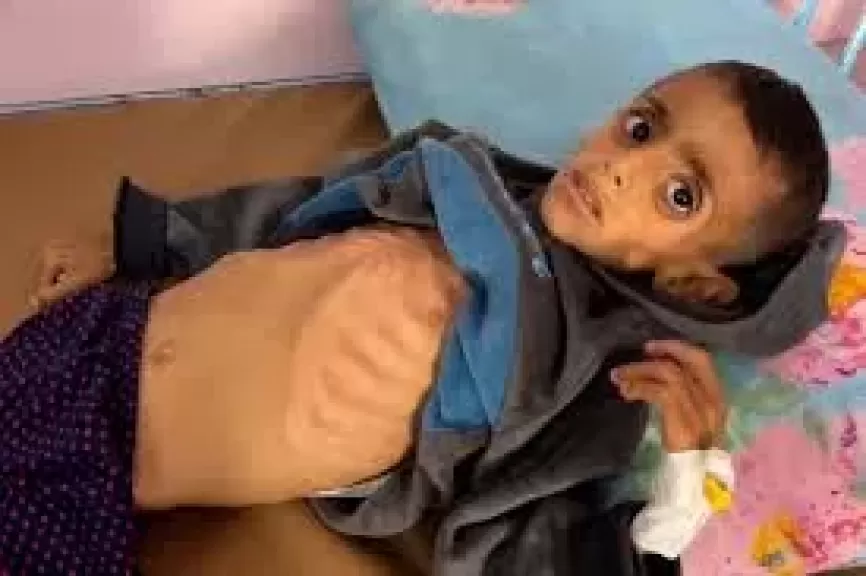 الصحة الفلسطينية : كل ساعة تمر تشهد وفاة مزيد من الأطفال بغزة