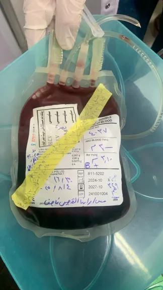 صحة الدقهلية تستحدث خدمة الدم المغسول والمفلتر لحماية مرضى نقل الدم المتكرر