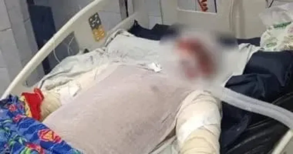 بعد تعثر نقله لمستشفى أهل مصر.. وفاة بطل حريق شبرا الخيمة متأثرا بإصاباته بحروق فى جميع أنحاء جسده