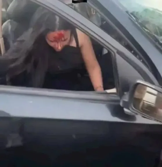 رنا فوزي مصابة حادث طريق الواحات أمام النيابة: الشباب طلبوا منا النزول من السيارة