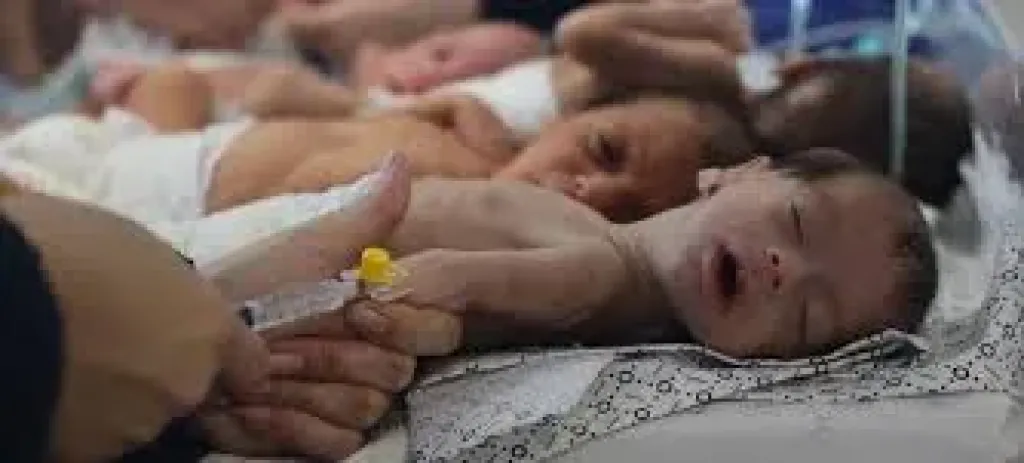وفاة 5 أشخاص بينهم طفلان نتيجة المجاعة وسوء التغذية فى غزة