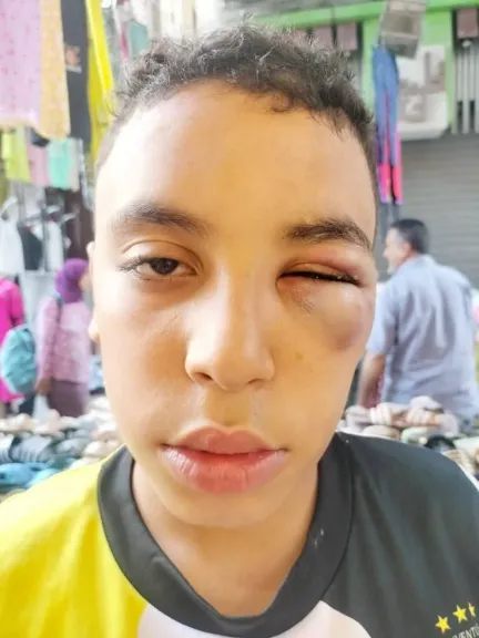 عام حبس لصاحب محلات ألبان شهيرة بالمحلة بعد اعتدائه على طفل وإصابته بعينه