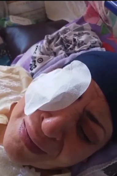 مأساة في المحلة.. تحقيق عاجل بعد فقدان سيدة لبصرها بسبب خطأ طبي