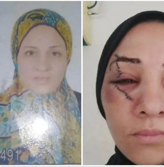 أصابها بـ30 غرزة.. أمن الغربية يضبط زوجًا بالمحلة اعتدى على زوجته والنيابة تأمر بحبسه 4 أيام
