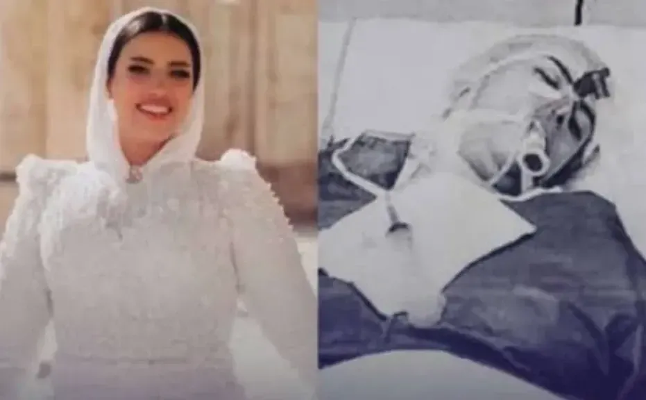 عمليات التجميل.. هوس ينتهي بالمأساة