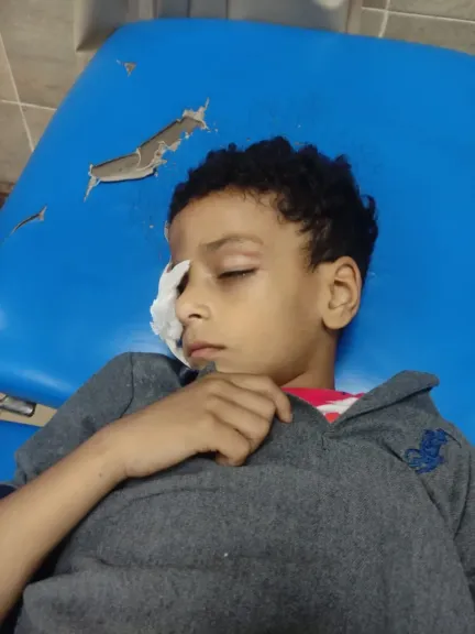 فقد عينه بسبب معملة.. تعليم قنا تفتح تحقيق عاجل في واقعة إصابة تلميذ داخل مدرسة في قنا