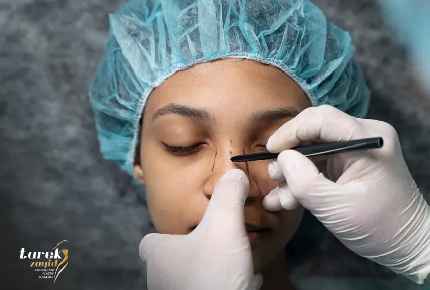 أفضل دكتور تجميل الأنف العظمي في مصر – دكتور طارق زايد
