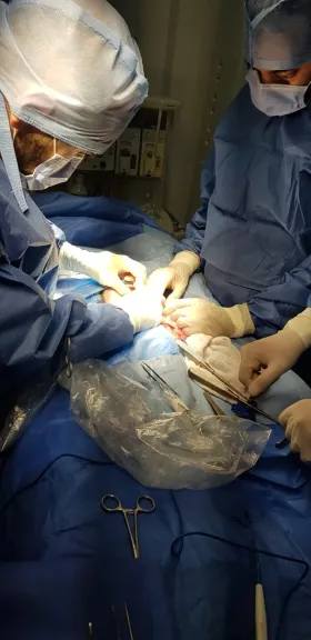 إنقاذ مولود عمره يومان بعد جراحة دقيقة لمعالجة عيب خلقي نادر بالشرج والقلب في مستشفى زاوية الناعورة