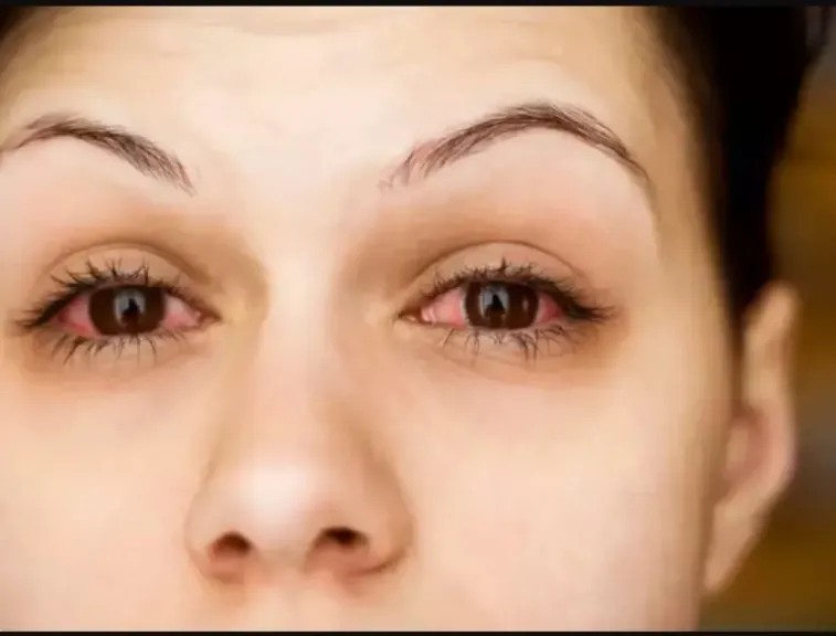 خطوات فعالة لتجنب إجهاد العين أثناء استخدام الشاشات