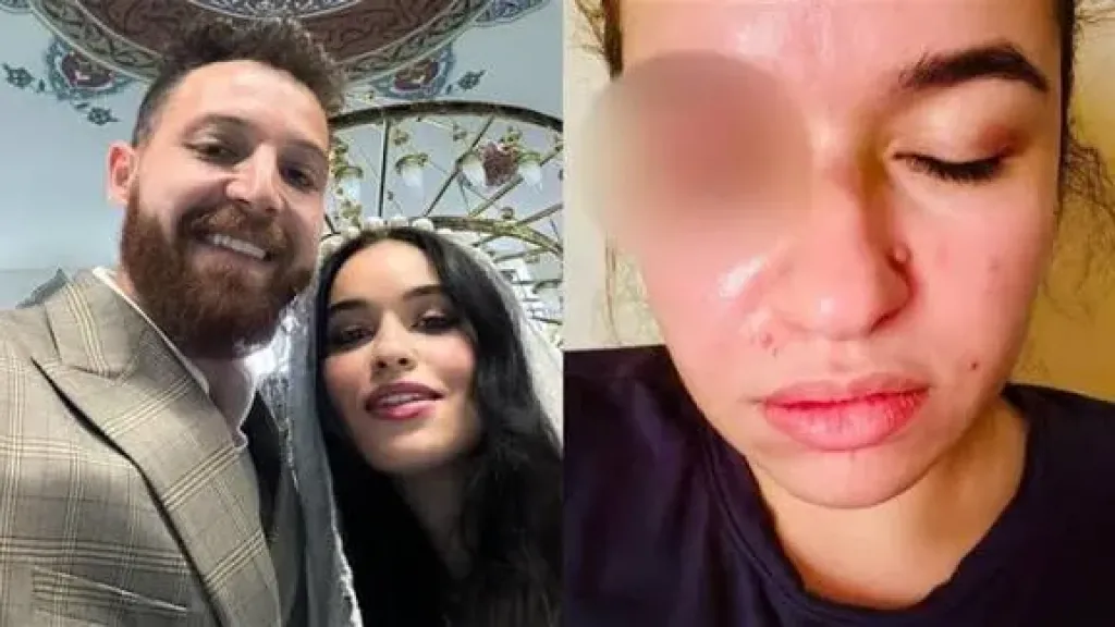 أول تعليق من محمود حجازي بعد بلاغ زوجته بالتعدي عليها بالضرب