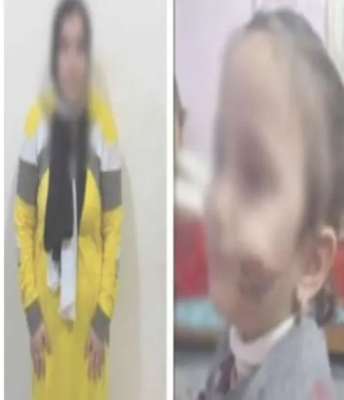 حبس ربة منزل 4 أيام لاتهامها بتعذيب طفلتها وحرق وجهها بكفر الشيخ