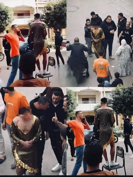 تفاصيل التقرير الطبي لشاب بنها بعد واقعة التعدي وإجباره على ارتداء ملابس نسائية