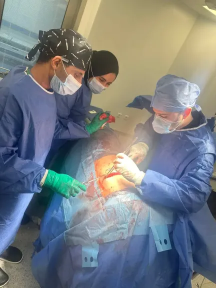 إنجاز طبي جديد.. أطباء جامعة بنها ينجحون في جراحة قلب مفتوح تنقذ مريضة