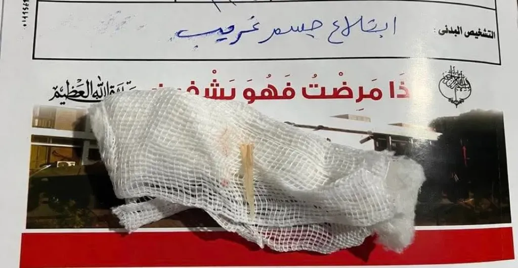 ابتلاع شوكة سمكة.. إنقاذ سيدة وصغير من جسم غريب بالأنف والأذن والحنجرة بمستشفى قنا العام