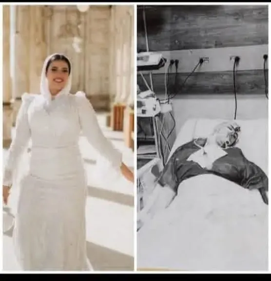 حنقة فيلر أنهت العروسة قبل الفرح .. قرار من المحكمة في قضية ”عروس حلوان”