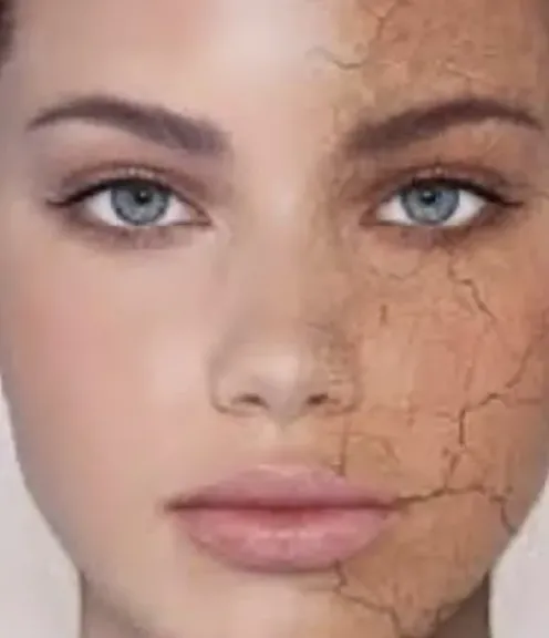 الزبادي.. كنز طبيعي لبشرة نضرة وخالية العيوب