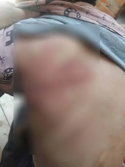 كدمات متفرقة بجسده.. أسرة تلميذ تتهم معلمة حضانة بالاعتداء عليه بالضرب في قنا | صور