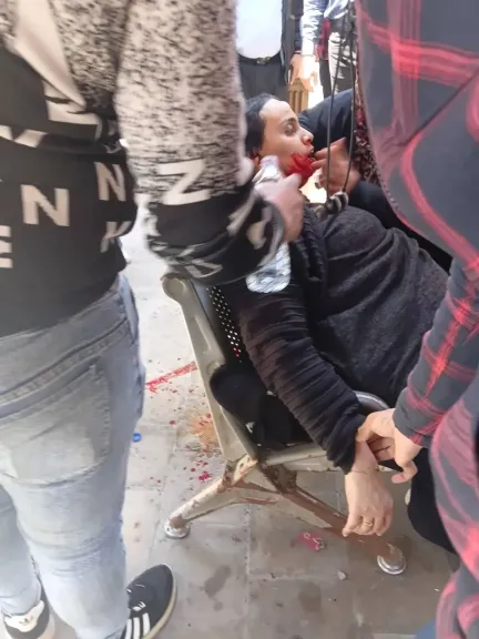 إصابة سيدة إثر انفجار تكييف أعلى محكمة جنايات المنشية