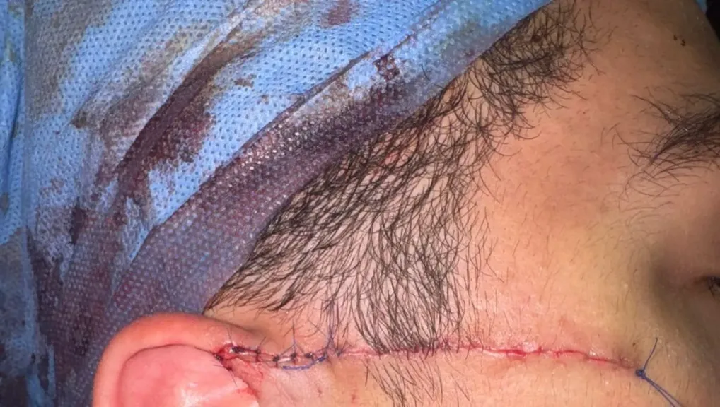 محراب العلم يتحول إلى «بلطجة».. طالب يشوه وجه زميله بآلة حادة بمدرسة السلام| خاص