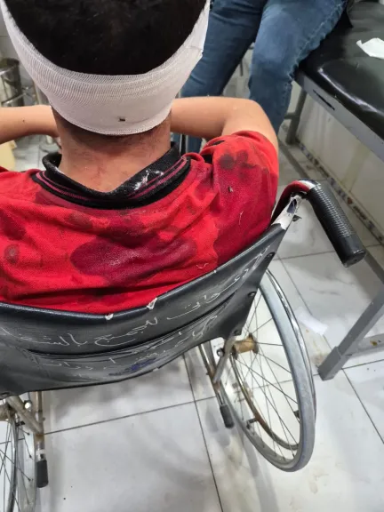 محراب العلم يتحول إلى «بلطجة».. طالب يشوه وجه زميله بآلة حادة بمدرسة السلام| خاص