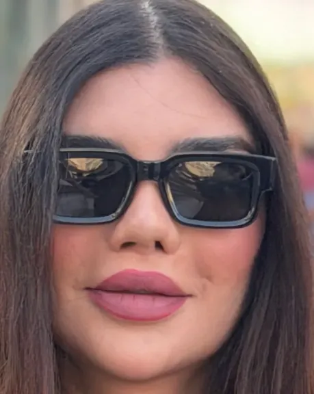 جويل بدر تكشف تفاصيل صادمة بعد تشوّه أنفها بعد عملية تجميل وتثير حالة من التفاعل