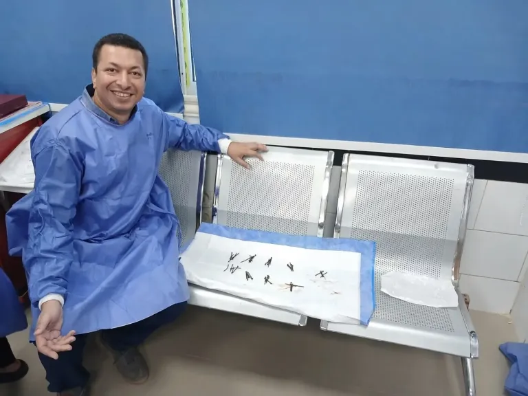 فاتح مصنع في معدته.. استخراج 100 مسمار وصامولة من معدة مريض بمستشفى جامعة بنى سويف