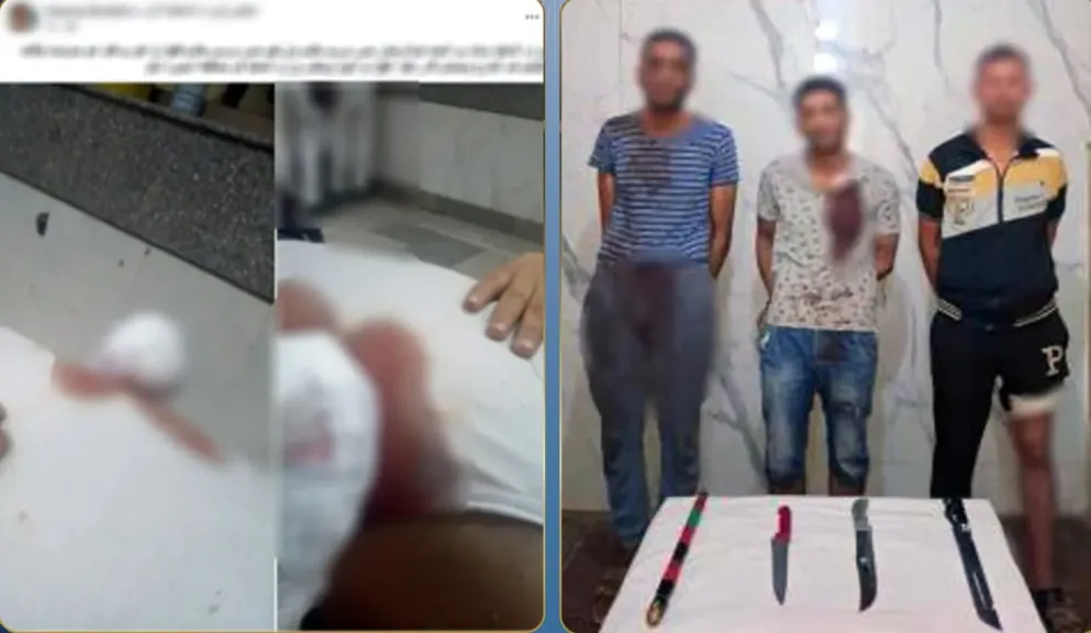 مشاجرة بين أقارب بسبب الميراث بالبحيرة تسفر عن إصابات وبتر وضبط أطراف الواقعة والأسلحة المستخدمة