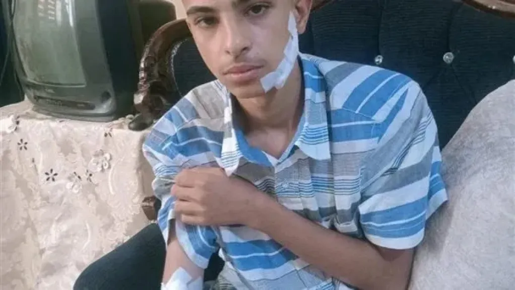 إصابة طالب بـ60 غرزة إثر اعتداء بسلاح أبيض في 6 أكتوبر.. ووالدته: لن أتنازل عن المحضر