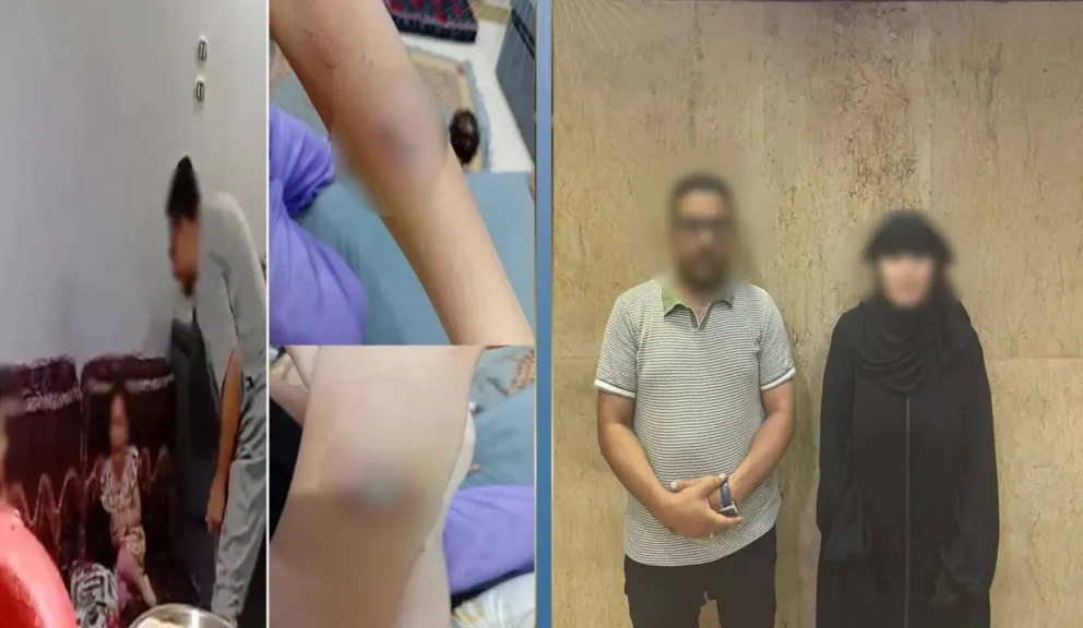 اعتداء داخل الأسرة.. كشف ملابسات إصابة طفلين على يد والديهما بحلوان