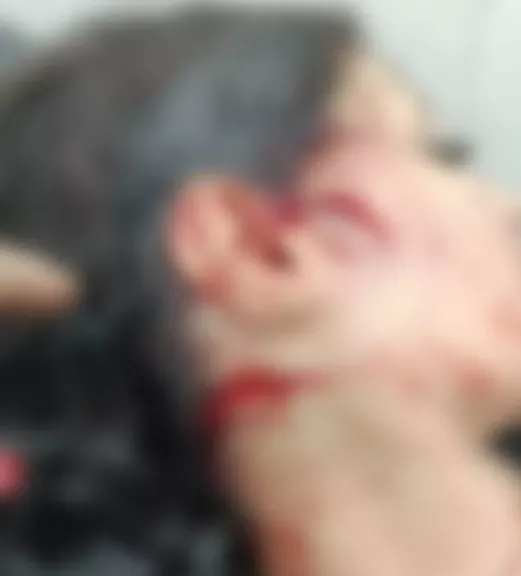 بعد 9 ساعات بين الحياة والموت.. تفاصيل الإعتداء الوحشي على سيدة في الخصوص